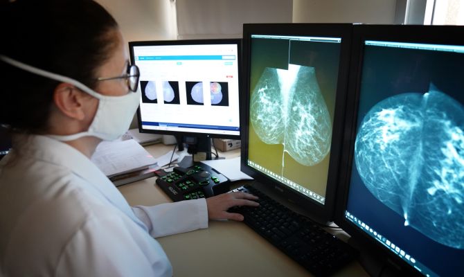 Tecnologia da Pixeon, implementada pelo Hospital de Amor gera economia que se reverte em mais exames, mais laudos e mais tratamento para mulheres que dependem da rede pública. (Foto: Divulgação)